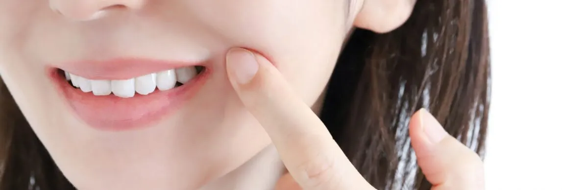 SH療法