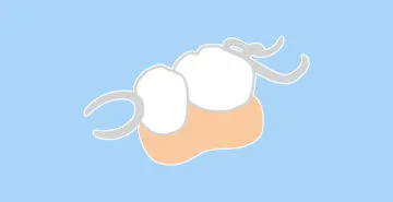 部分入れ歯