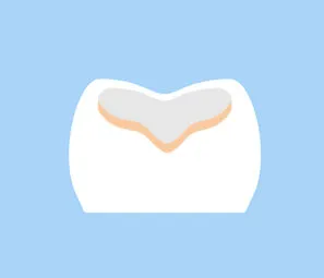 ドックスベストセメント