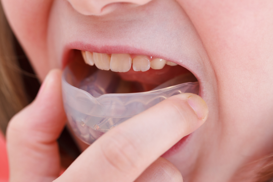 小児矯正の写真