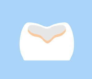 ドックスベストセメント