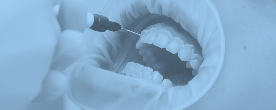 ホワイトニング